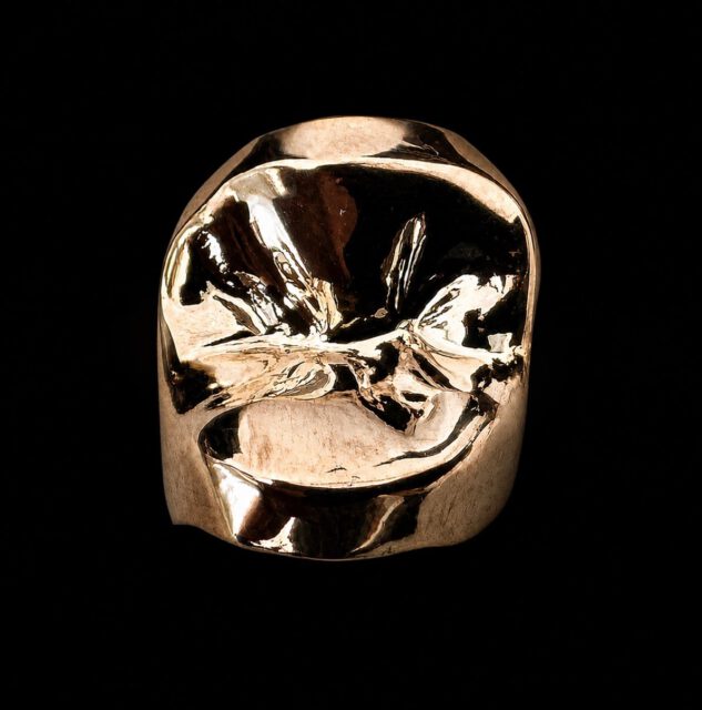 Wat is het toch mooi om een gouden inlay te maken!