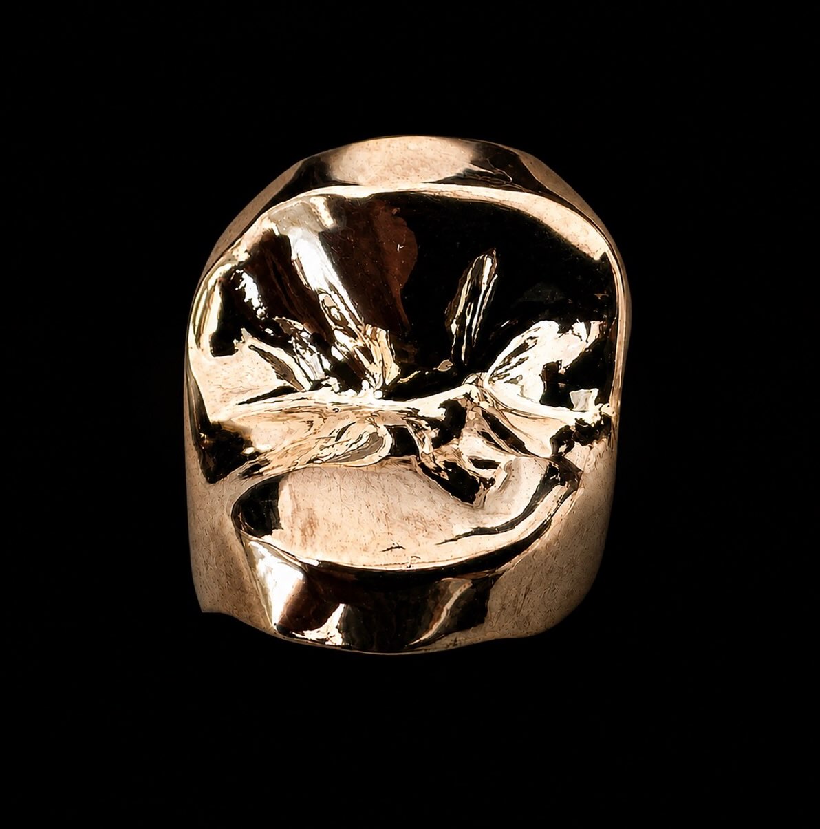 Wat is het toch mooi om een gouden inlay te maken!